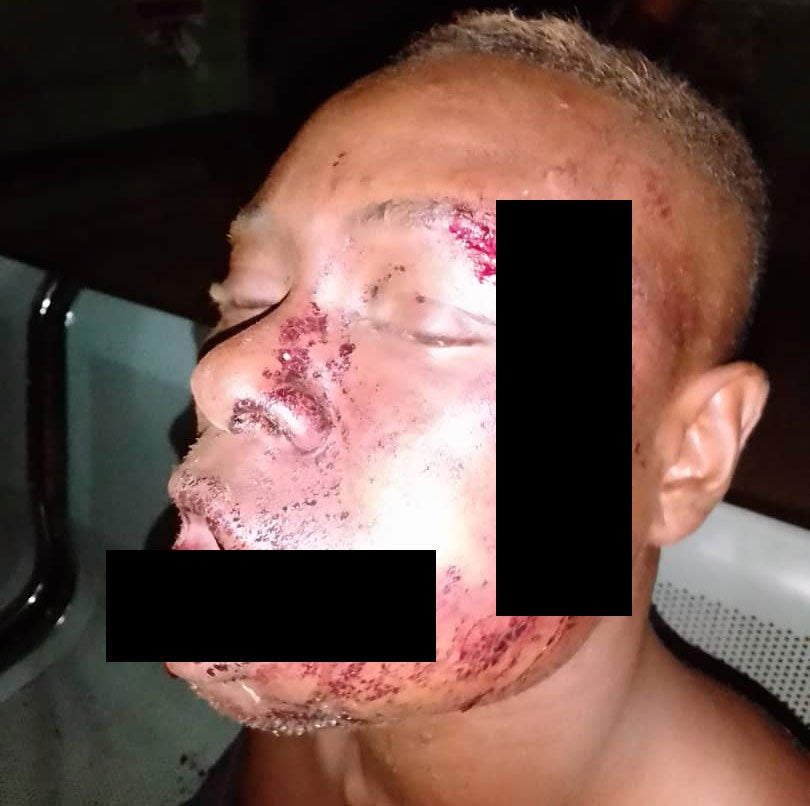 Fulani herdsmen attack OPC member in Ondo